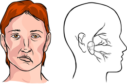 Cách loại bỏ thói quen gây đột quỵ chúng ta thường mắc mà không biết- Ảnh 3.