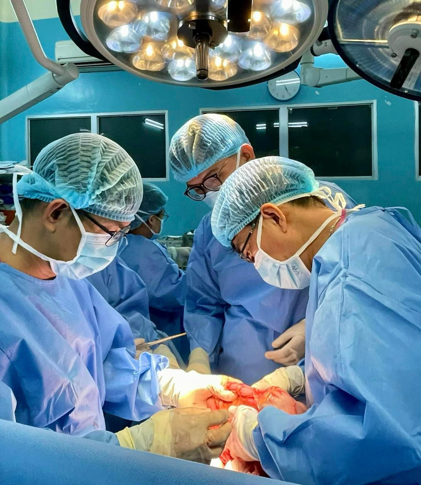 Nhiều cháu bé không thể ghép gan vì... cha mẹ bị gan nhiễm mỡ- Ảnh 1. Các bác sĩ Bệnh viện Nhi đồng 2 đang ghép gan cho một bệnh nhi - Ảnh: Bệnh viện cung cấp