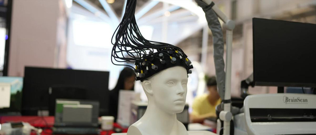 A device for scanning the human brain - Photo: AP