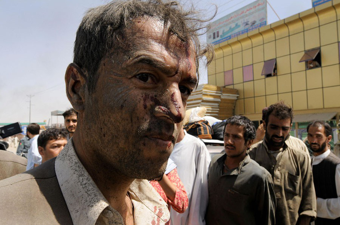 Những bức ảnh còn lại của phóng viên AFP vừa mất trong vụ đánh bom - Ảnh 2.