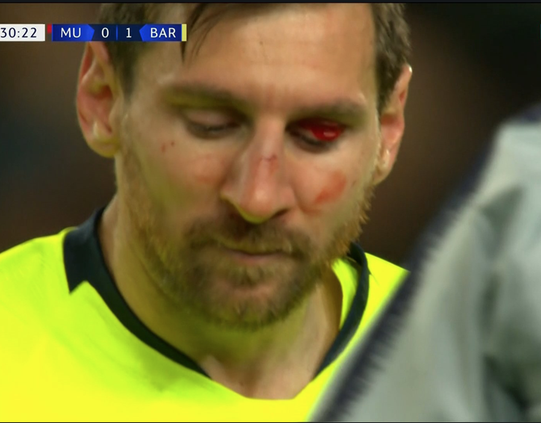 Messi đổ máu trong chiến thắng của Barca trước M.U - Ảnh 5.