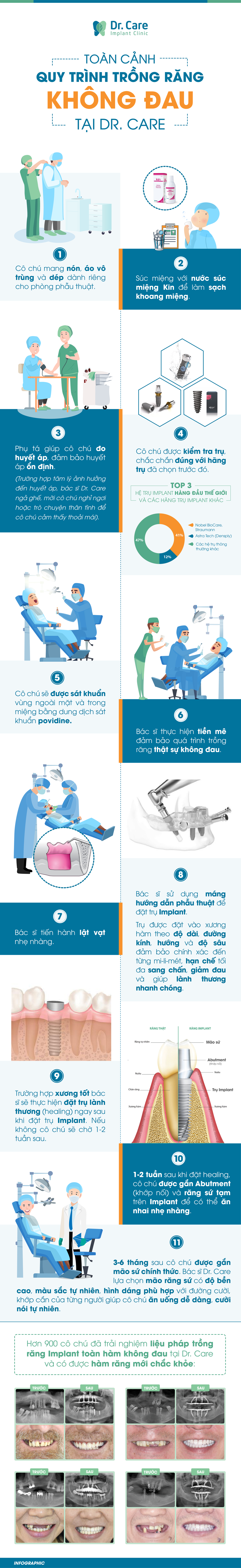 Toàn cảnh ca trồng răng Implant không đau tại nha khoa chuyên sâu - Ảnh 2.
