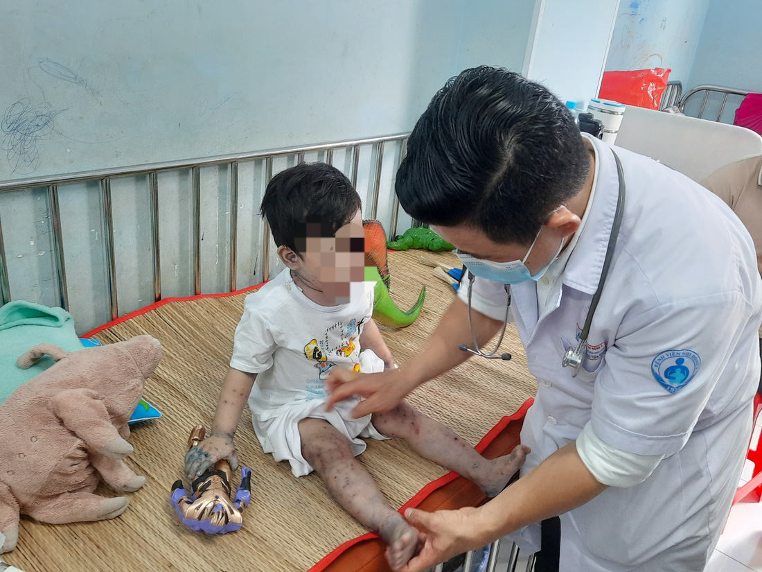 Trẻ mắc tay chân miệng được điều trị tại Bệnh viện Nhi đồng 1 (TP.HCM) - Ảnh: THU HIẾN