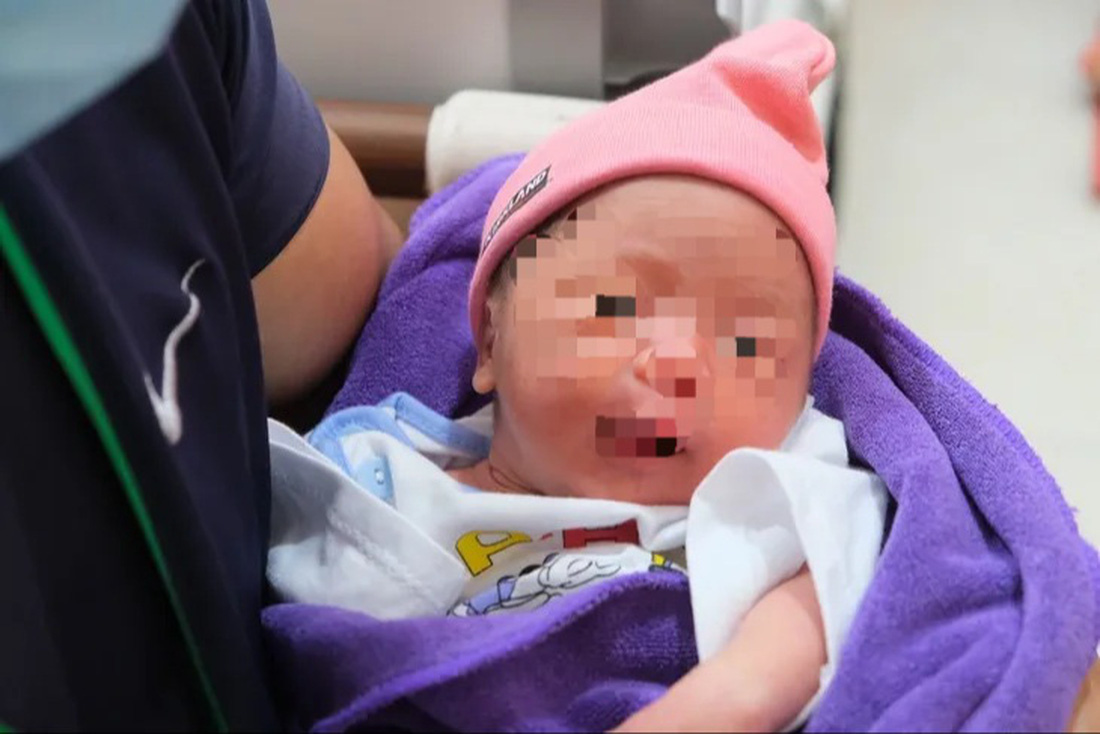 Trẻ sơ sinh một thai phụ bị vỡ tử cung do nhau cài răng lược được cứu sống tại Bệnh viện Hùng Vương TP.HCM - Ảnh: Bệnh viện cung cấp