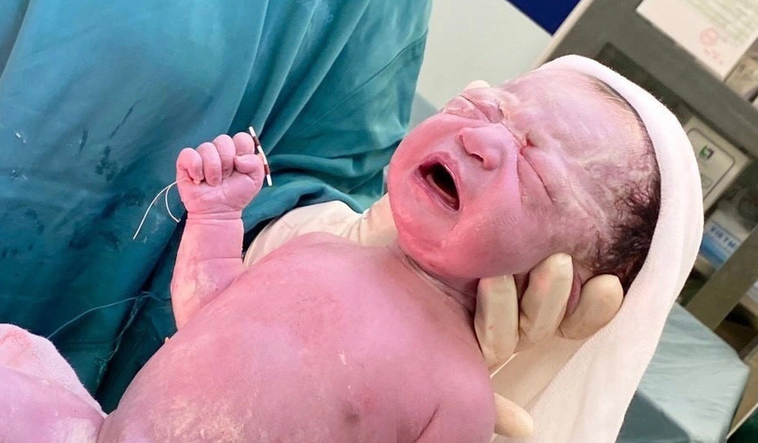 Bé sơ sinh được sinh ra cùng với vòng tránh thai của mẹ - Ảnh: Bệnh viện cung cấp