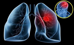 Nghiên cứu mới: Dụng cụ nấu bếp bằng nhựa đen có nguy cơ gây ung thư - Ảnh 2.