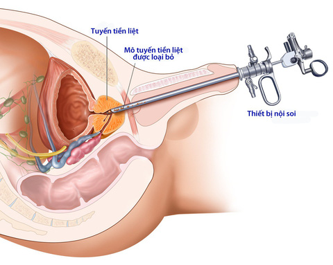 3. Biện pháp điều trị và phòng ngừa