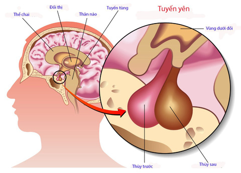 Cách kích thích sản xuất hormone tăng trưởng tự nhiên