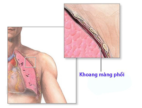 4. Phương Pháp Chẩn Đoán