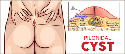 4. Phương pháp chẩn đoán và khám bệnh