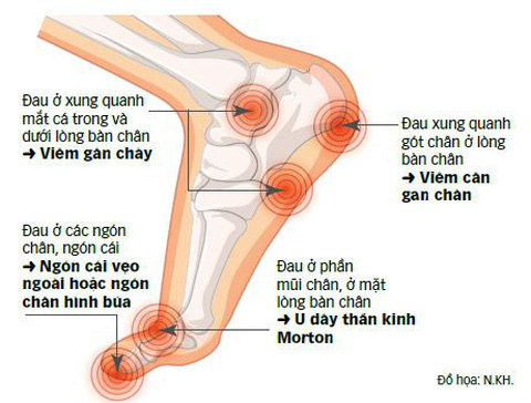 4. Phương Pháp Điều Trị Đau Má Trong Bàn Chân