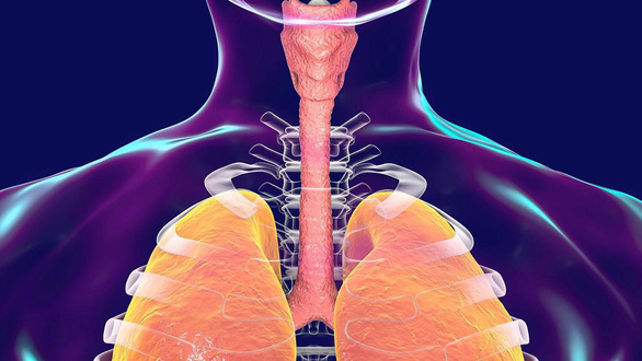 Những ca ghép để đời - kỳ 5: Ghép khí quản bằng động mạch chủ - Ảnh 3.