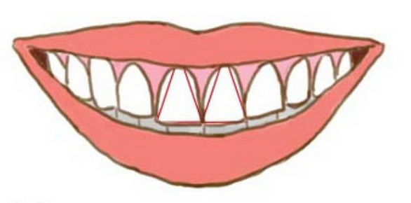 Nhìn răng biết tính cách? - Ảnh 4. Nhìn răng biết tính cách? - Ảnh 4.