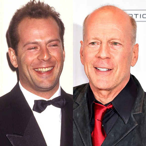 Với The Rock, Vin Diesel, Bruce Willis... thì hói vẫn rất đẹp - Ảnh 5. Với The Rock, Vin Diesel, Bruce Willis... thì hói vẫn rất đẹp - Ảnh 5.