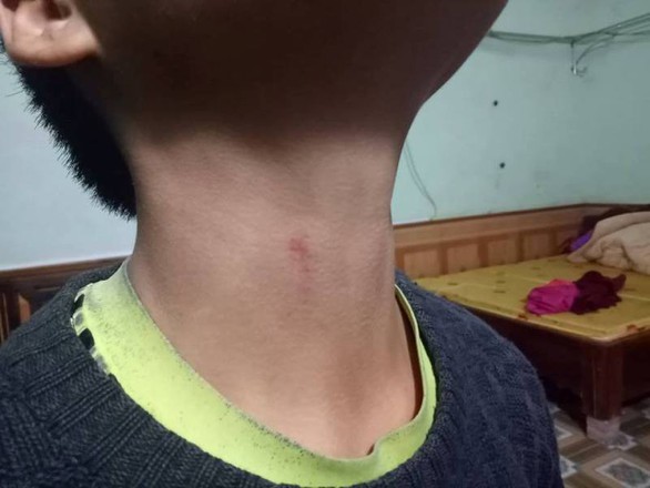 Phụ huynh tố hiệu trưởng bóp cổ học sinh, hiệu trưởng phản bác - Ảnh 2. Phụ huynh tố hiệu trưởng bóp cổ học sinh, hiệu trưởng phản bác - Ảnh 2.