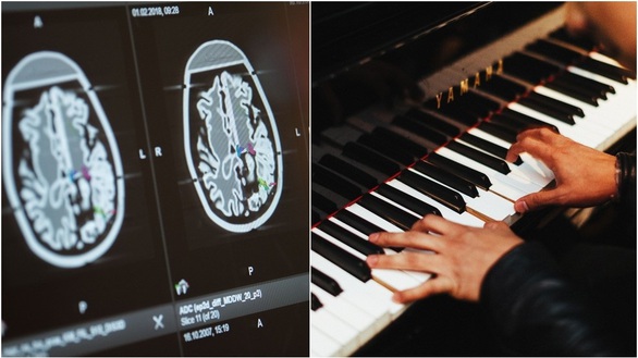 Kỳ lạ nghệ sĩ chơi piano trong khi được phẫu thuật não - Ảnh 1. Kỳ lạ nghệ sĩ chơi piano trong khi được phẫu thuật não - Ảnh 1.