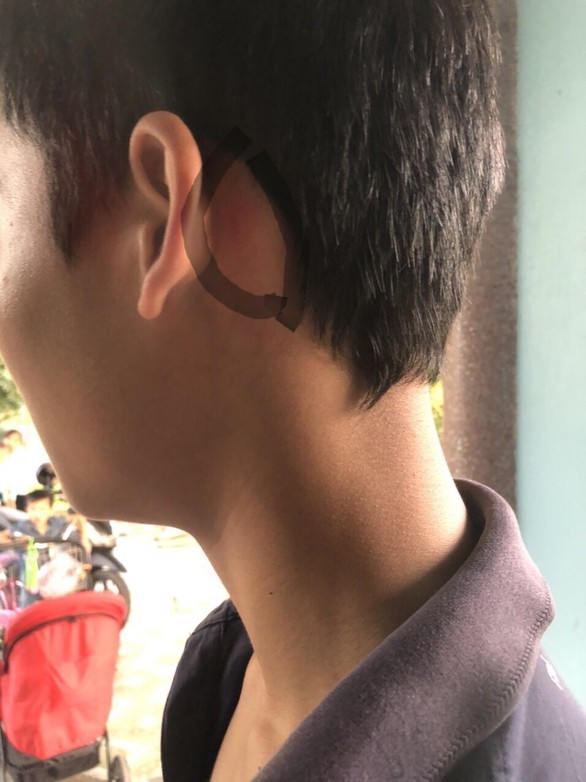 5 người lớn đi ôtô xông vào trường đánh 1 nam sinh lớp 8 - Ảnh 2. 5 người lớn đi ôtô xông vào trường đánh 1 nam sinh lớp 8 - Ảnh 2.