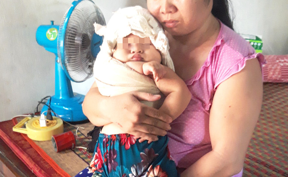 Bé gái bị liệt tay sau sinh, bác sĩ nói ở đâu cũng xảy ra, chỉ ít hay nhiều thôi - Ảnh 1. Bé gái bị liệt tay sau sinh, bác sĩ nói ở đâu cũng xảy ra, chỉ ít hay nhiều thôi - Ảnh 1.