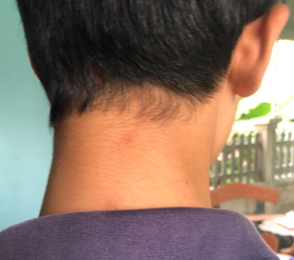 Nhóm người lớn đi ôtô xông vào trường đánh nam sinh lớp 8 bị phạt 4,4 triệu - Ảnh 1. Nhóm người lớn đi ôtô xông vào trường đánh nam sinh lớp 8 bị phạt 4,4 triệu - Ảnh 1.
