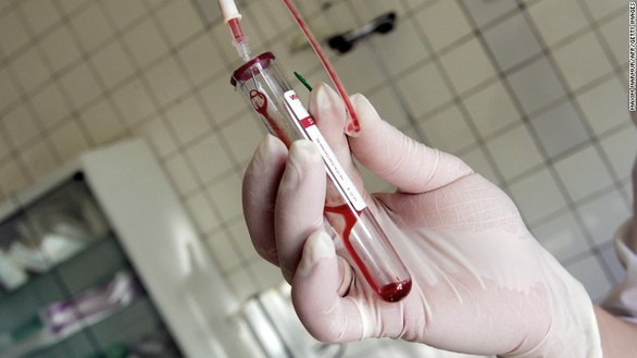 Phát hiện thêm chủng HIV mới - Ảnh 1. Phát hiện thêm chủng HIV mới - Ảnh 1.