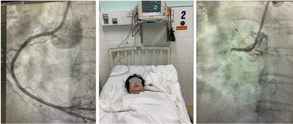 10 ca cấp cứu ấn tượng của ngành y tế TP.HCM năm 2019 - Ảnh 5. 10 ca cấp cứu ấn tượng của ngành y tế TP.HCM năm 2019 - Ảnh 5.