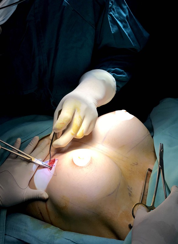 Dành cả thanh xuân đập đi xây lại gương mặt của mình - Ảnh 8. Dành cả thanh xuân đập đi xây lại gương mặt của mình - Ảnh 8.