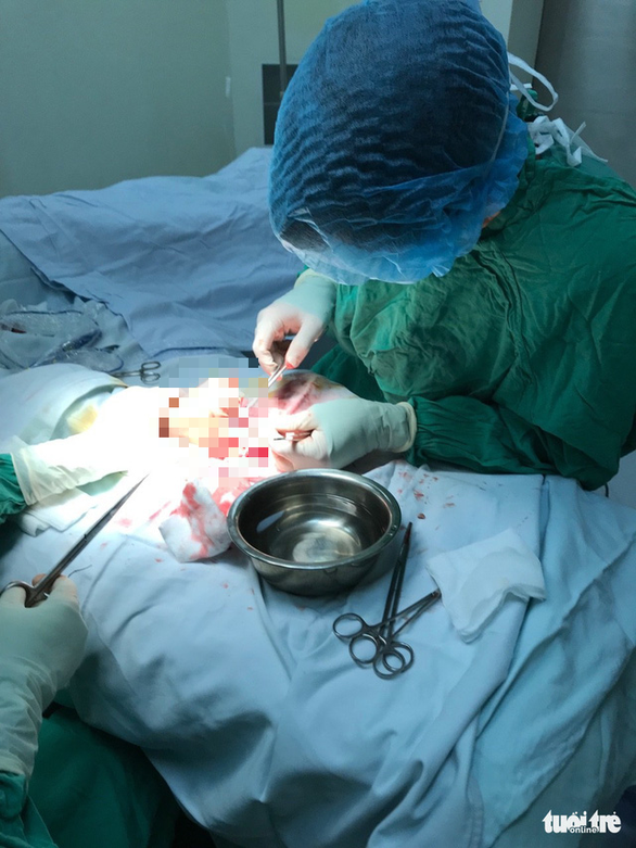 Đứt lìa bàn tay vì máy cắt chuối cây - Ảnh 1. Đứt lìa bàn tay vì máy cắt chuối cây - Ảnh 1.