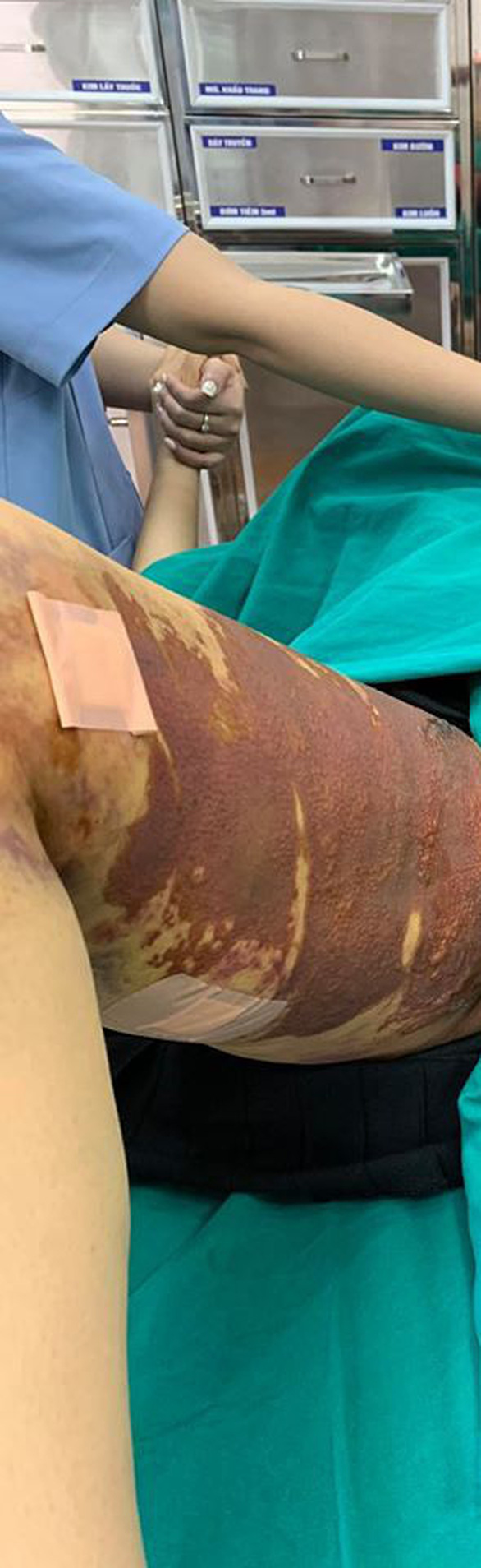 Nữ bệnh nhân bị tai biến khi hút mỡ tại thẩm mỹ viện Việt Hàn - Ảnh 1.