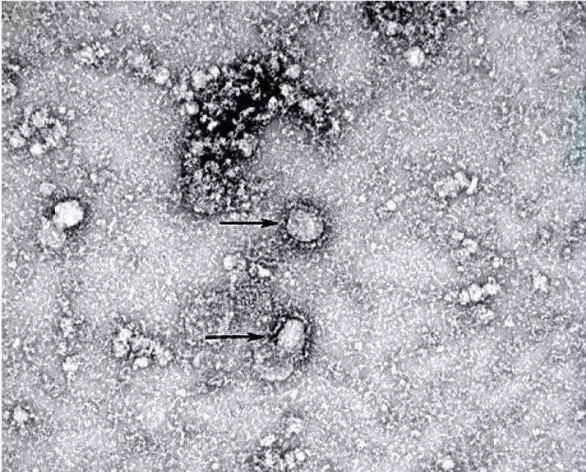 Mất bao lâu mới có được văcxin ngừa virus corona mới? - Ảnh 1. Mất bao lâu mới có được văcxin ngừa virus corona mới? - Ảnh 1.