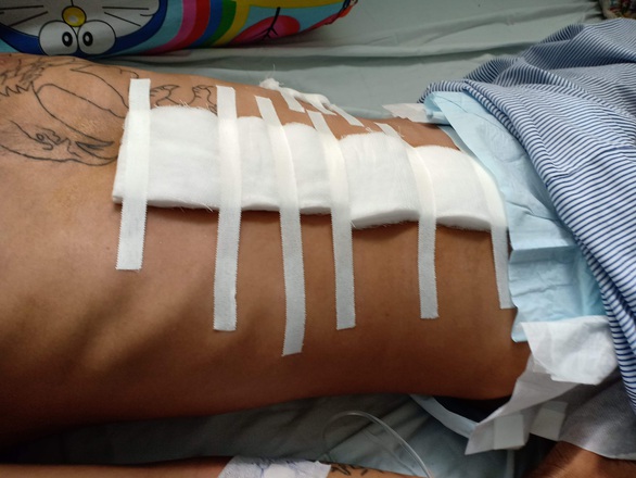 Bị phát hiện rượt trộm dê, kéo băng xách súng bắn gục 3 người - Ảnh 1. Bị phát hiện rượt trộm dê, kéo băng xách súng bắn gục 3 người - Ảnh 1.