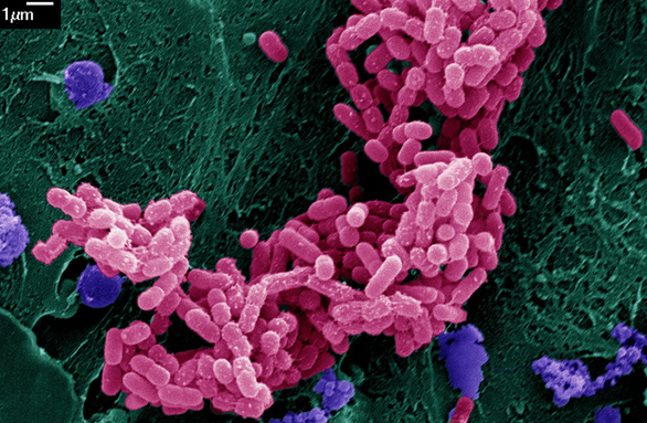 Khám phá ra cách vi khuẩn đấu với kháng sinh - Ảnh 1.