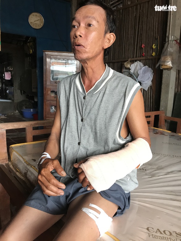 Nhiều người bị khỉ sổng chuồng cắn bị thương - Ảnh 1. Nhiều người bị khỉ sổng chuồng cắn bị thương - Ảnh 1.