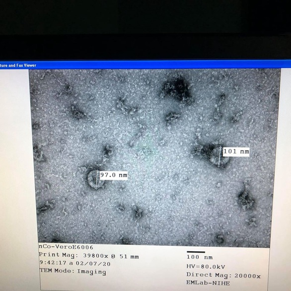 Dự kiến cuối tuần tới sẽ có bộ kit xét nghiệm virus corona made in Việt Nam - Ảnh 1. Dự kiến cuối tuần tới sẽ có bộ kit xét nghiệm virus corona made in Việt Nam - Ảnh 1.