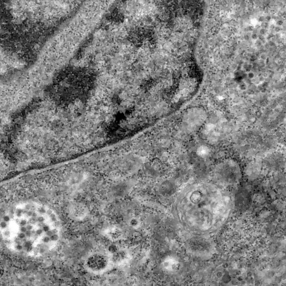 Lần đầu ghi được khoảnh khắc virus corona tấn công tế bào - Ảnh 3.