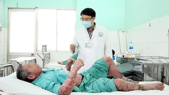 Bôi thuốc dân tộc vô, toàn thân sưng vù, nứt da, đóng vảy... - Ảnh 1. Bôi thuốc dân tộc vô, toàn thân sưng vù, nứt da, đóng vảy... - Ảnh 1.