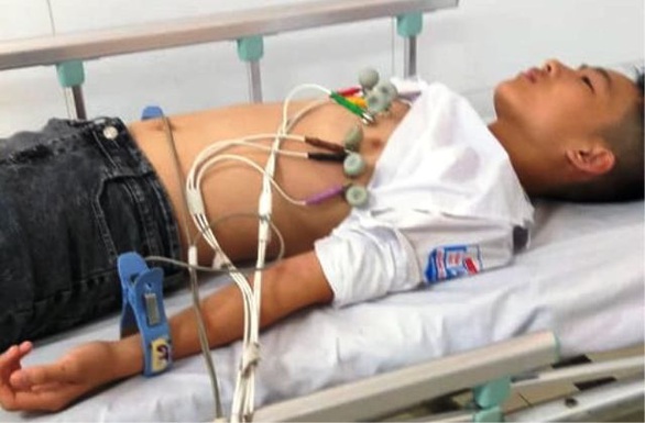 Thầy giáo dạy thể dục bị phụ huynh tố tát học sinh nhập viện - Ảnh 1. Thầy giáo dạy thể dục bị phụ huynh tố tát học sinh nhập viện - Ảnh 1.