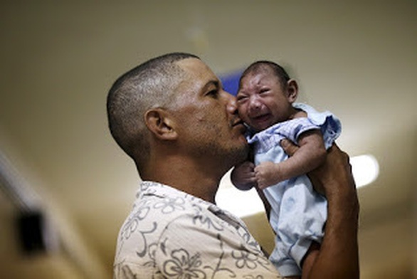 Phát hiện một bệnh nhân nhiễm virus Zika gây bệnh đầu nhỏ - Ảnh 1. Phát hiện một bệnh nhân nhiễm virus Zika gây bệnh đầu nhỏ - Ảnh 1.