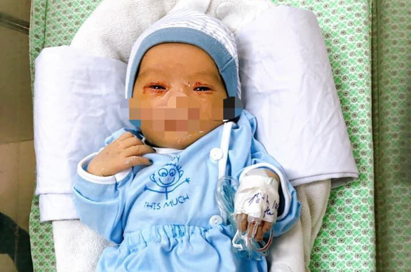 Bé sơ sinh bị bỏ rơi hơn 40 giờ nghi bị nhiễm trùng máu, bác sĩ dồn lực cứu chữa - Ảnh 1. Bé sơ sinh bị bỏ rơi hơn 40 giờ nghi bị nhiễm trùng máu, bác sĩ dồn lực cứu chữa - Ảnh 1.