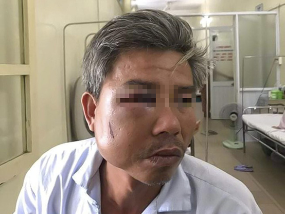 Treo quảng cáo trái phép, chủ cà phê Bố Già còn đánh bầm dập nhân viên Công ty cây xanh - Ảnh 1. Treo quảng cáo trái phép, chủ cà phê Bố Già còn đánh bầm dập nhân viên Công ty cây xanh - Ảnh 1.