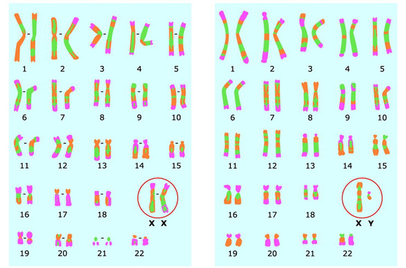 Bí mật của COVID-19: Đã có bão cytokine lại còn thêm bão bradykinin - Ảnh 3.