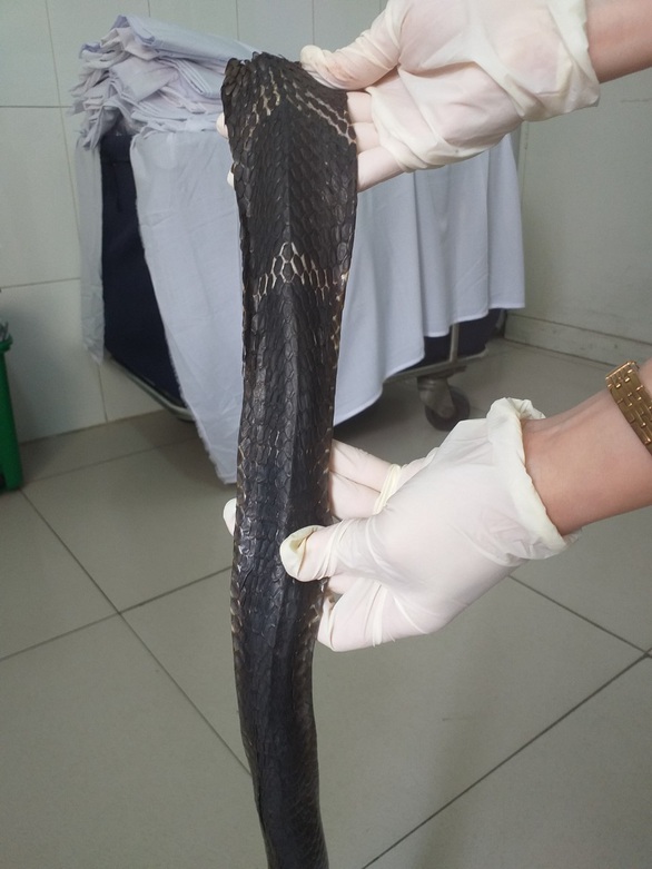 TP.HCM: Thêm một người bị rắn hổ mang chúa cắn - Ảnh 1. TP.HCM: Thêm một người bị rắn hổ mang chúa cắn - Ảnh 1.