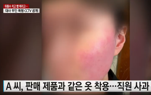Vợ đại sứ Bỉ tại Hàn Quốc nhập viện sau khi tát nổ đom đóm người bán hàng - Ảnh 1.