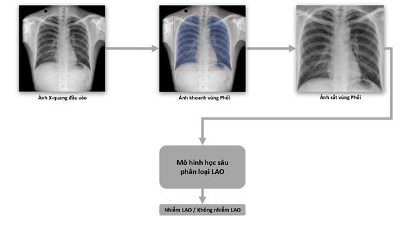 Phát hành sách trắng về ứng dụng trí tuệ nhân tạo cho chẩn đoán và tầm soát bệnh lao - Ảnh 1.