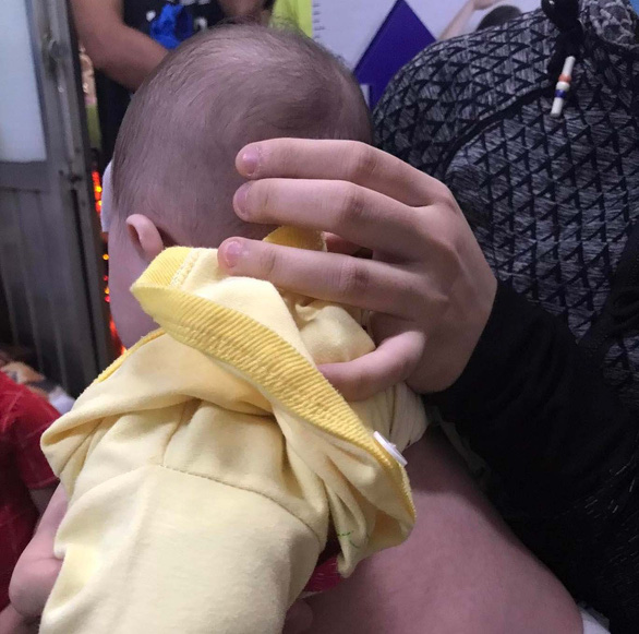 Cảnh giác bé 4 tháng tuổi sốt xuất huyết giả dạng là sốt phát ban - Ảnh 1.