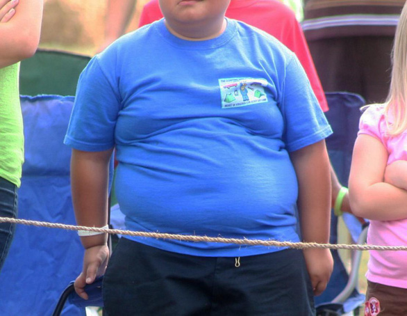 New discovery can help treat childhood obesity - Photo 1.