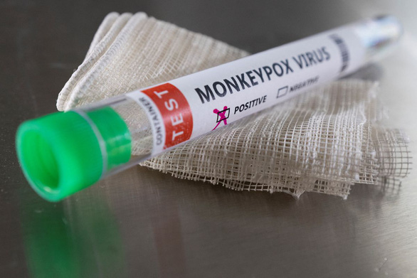England supervises monkeypox, Denmark has the first case - Photo 1.