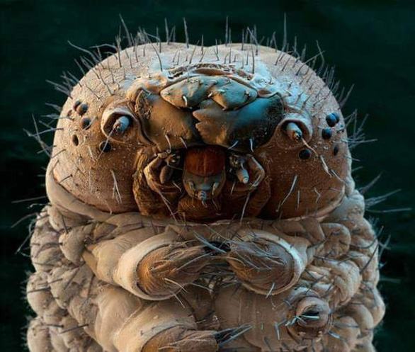 Did you know: Under the skin of your face, hundreds of microscopic spiders live leisurely?  - Photo 3.