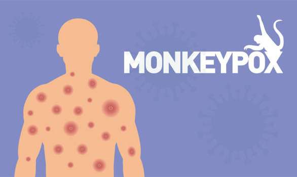 Tại sao các nhà khoa học đòi WHO phải đổi tên virus đậu mùa khỉ? - Ảnh 1.