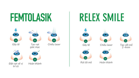 Sử dụng tia laser công nghệ cao để điều trị các tật khúc xạ - Ảnh 2.