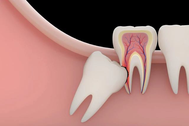 Những bộ phận thất nghiệp trên cơ thể người - Ảnh 8.